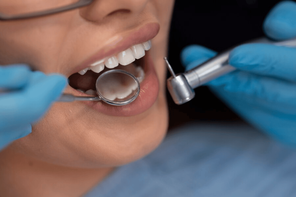 Maintaining Your Dental Bridges for Long-Term Success